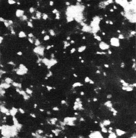 Атомы урана на углеродной подложке, сфотографированные с помощью растрового просвечивающего электронного микроскопа. А. Крю, примерно 1970 г. (Музей науки, Лондон.)
